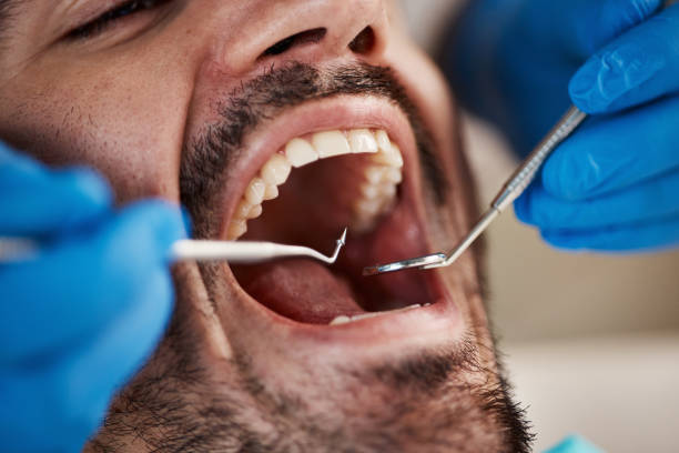 Best Tooth Infection Emergency Dentist  in Kinnelon, NJ