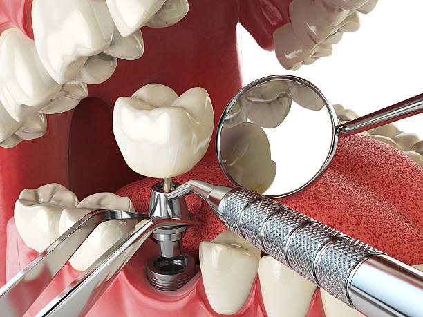 Best Emergency Tooth Extraction  in Kinnelon, NJ